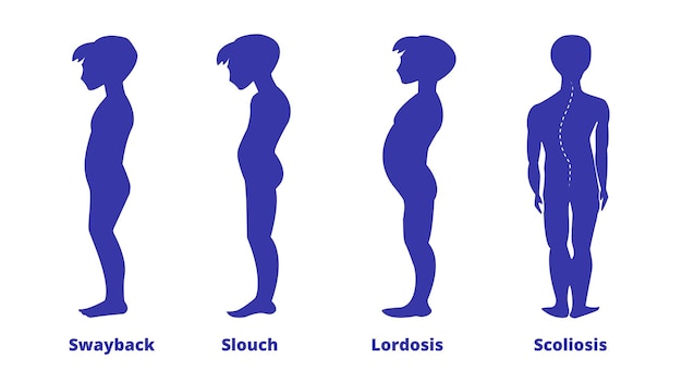 Premium Vector | Diseases Of The Spine. Scoliosis, Lordosis, Swayback ...