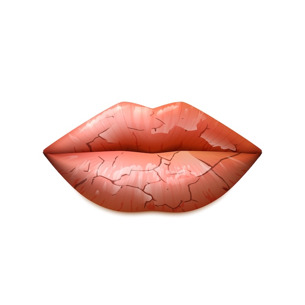 Dry lips illustration Free Vector