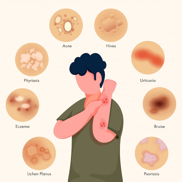 Premium Vector | Faceless young boy itching his hands and showing ...