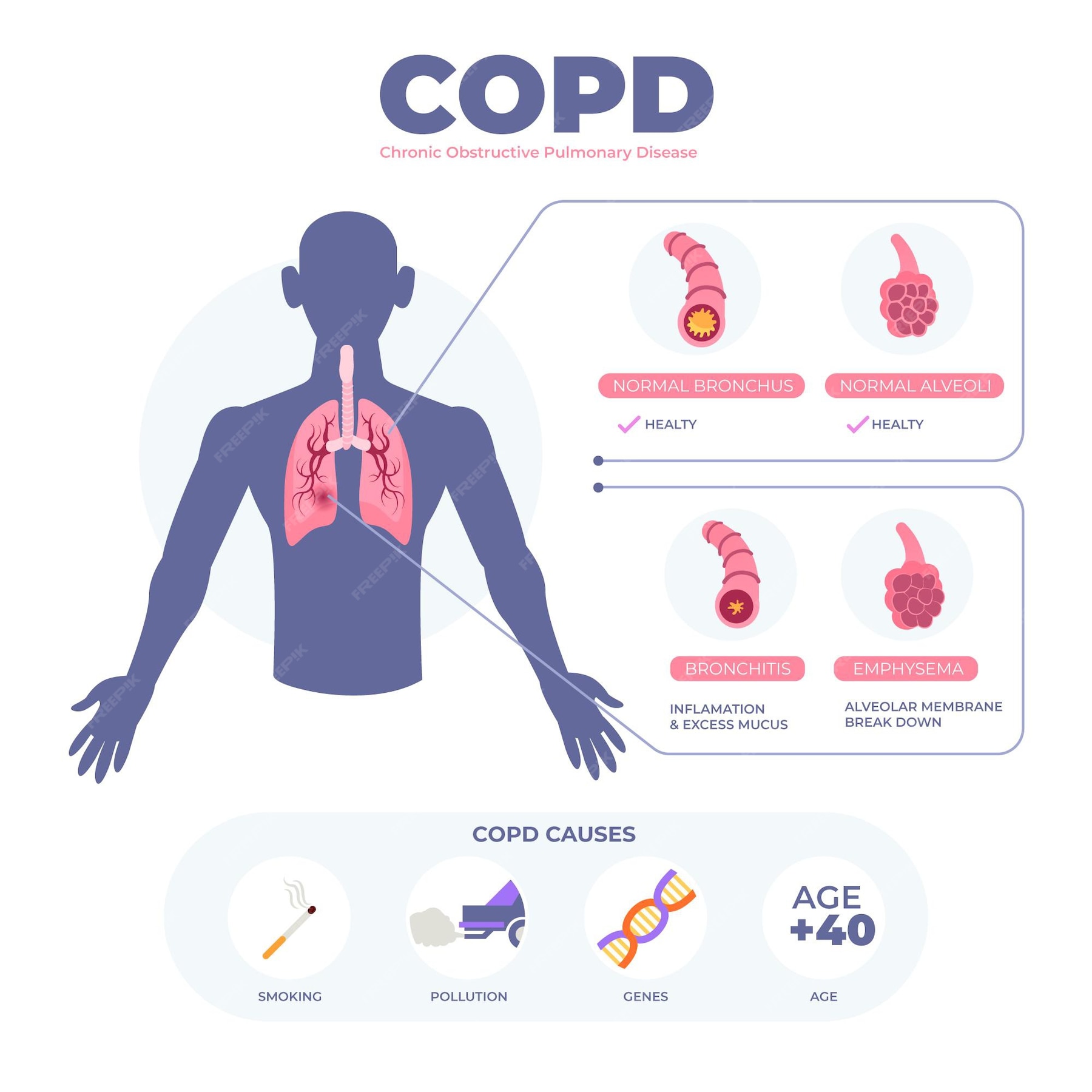 Free Vector | Flat-hand drawn copd infographic template