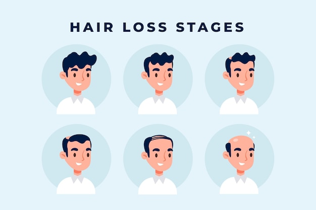 causes hair loss, Hair loss stages