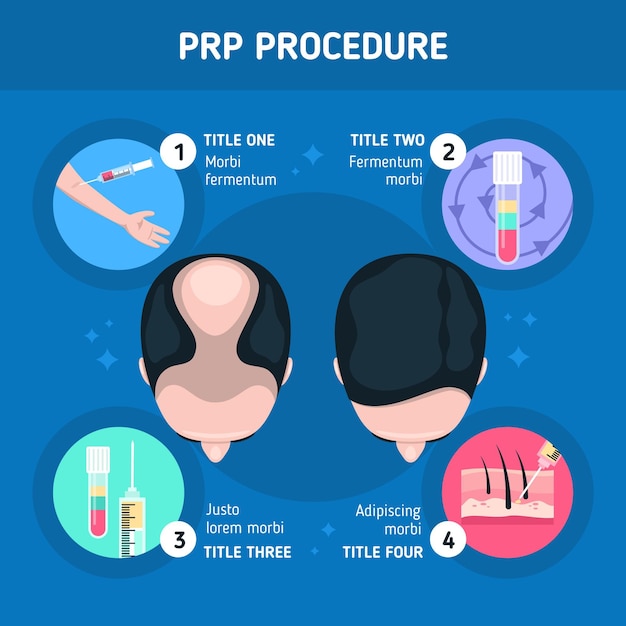 Free Vector | Flat-hand drawn prp procedure infographic template