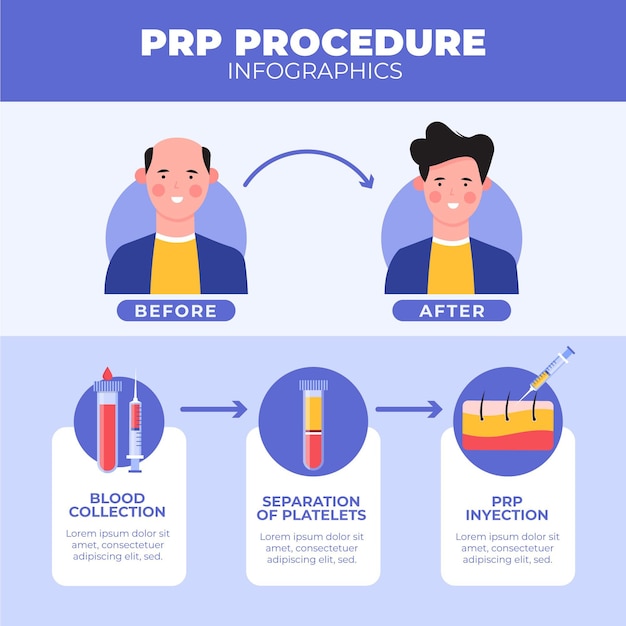 Free Vector | Flat-hand drawn prp procedure infographic