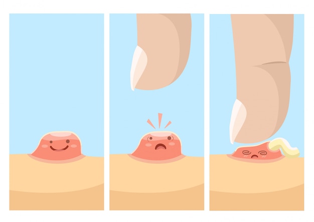 Funny illustration of a life a pimple | Premium Vector