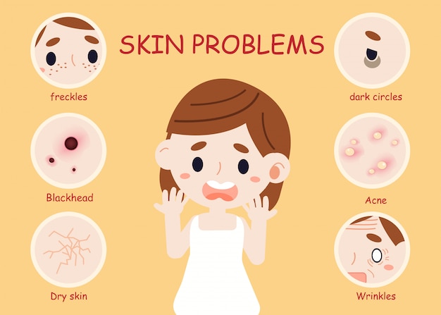 Featured image of post Skin Problem Cartoon / Others require medical attention during pregnancy.