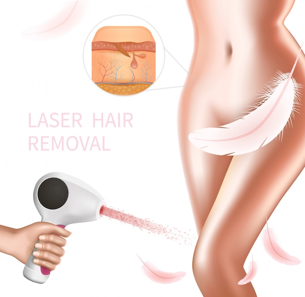 Hair laser removal procedure on female bikini area Vector ...