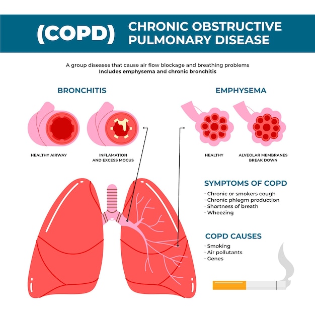 Premium Vector | Hand drawn copd infographic