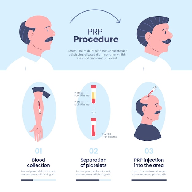 Free Vector | Hand drawn prp procedure infographic