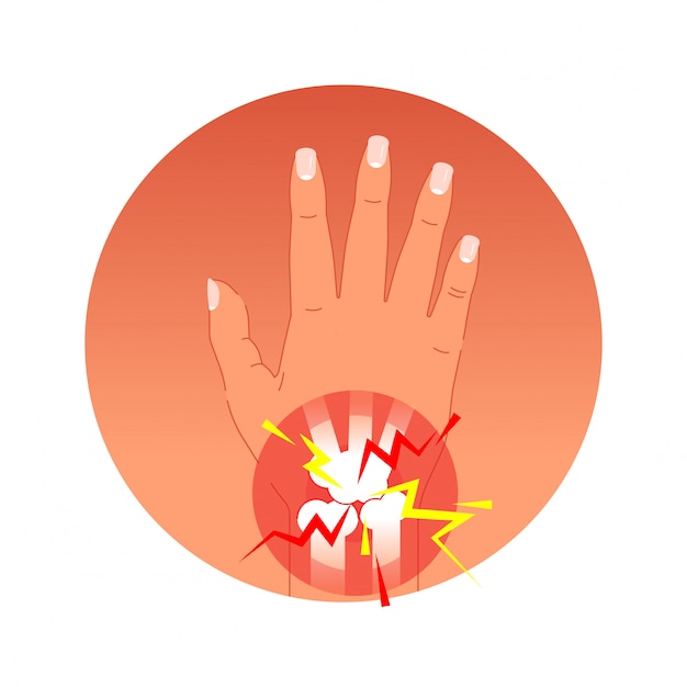 Premium Vector | Hand joint pain concept vector illustration