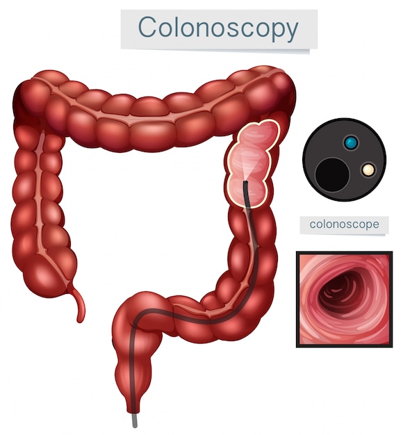 Premium Vector | Human anatomy colonoscopy on white background