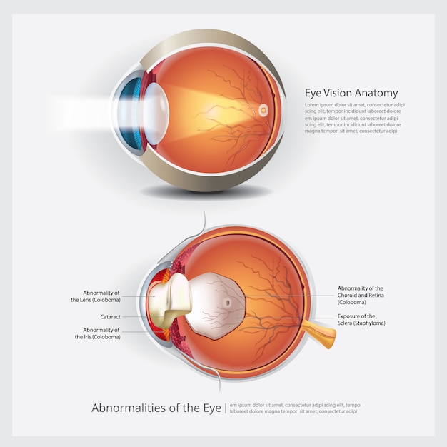 Premium Vector | Human eye anatomy and normal lens vector illustration