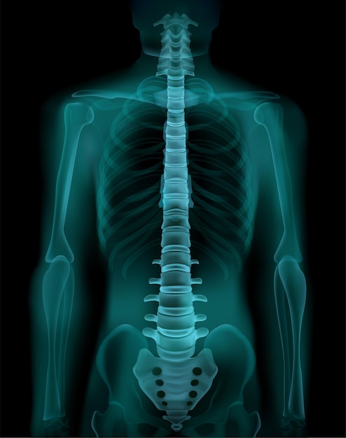Фото рентгена человека