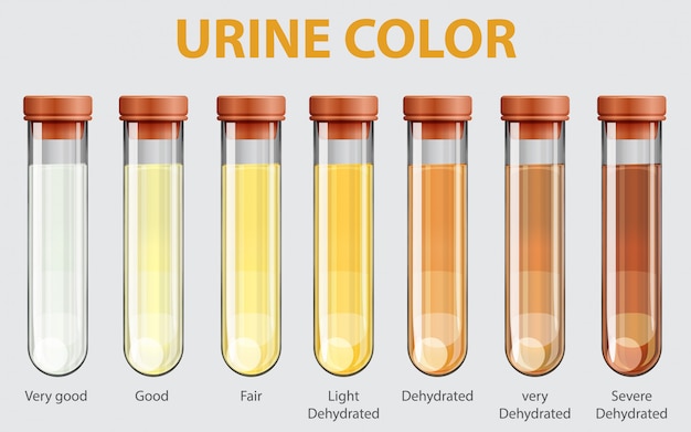 Free Vector Illustration Of Urine Color Chart 8283