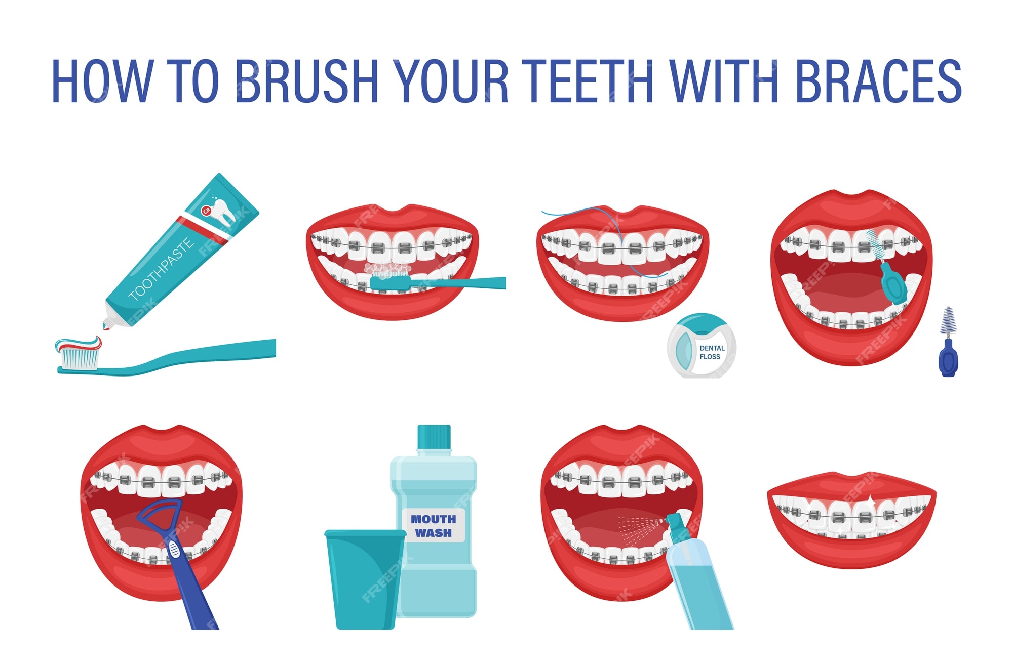 How To Brush Your Teeth With Braces Step By Step