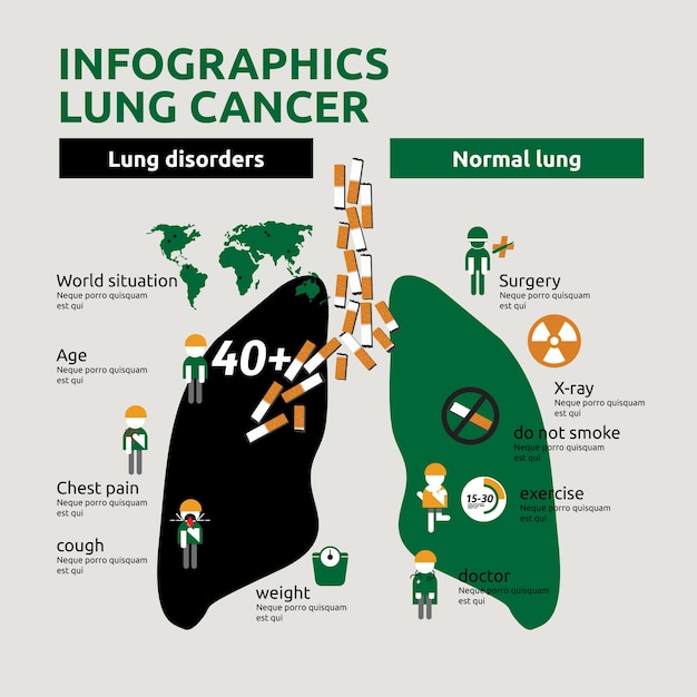 Infographics About Lung Cancer Risk Factors And Symptoms Vector