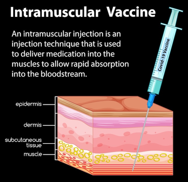 Intramuscular Injections Ppt - Riset