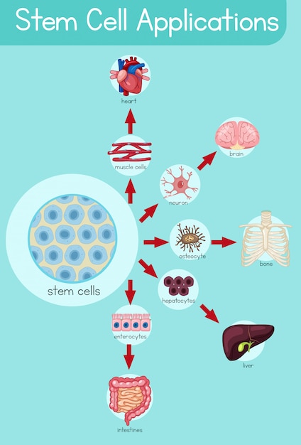 Premium Vector Informative Poster Of Stem Cell Applications