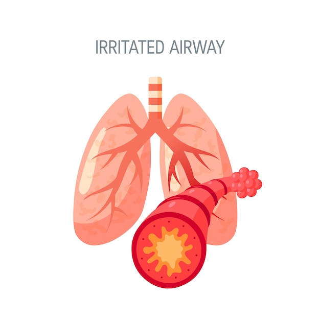 Premium Vector | Irritated airway concept in flat style.