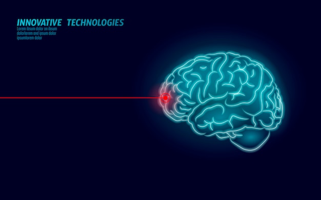 レーザー外科医の脳治療低ポリ3 Dレンダリング 薬物向知性人間能力スマートメンタルヘルス アルツハイマー病と認知症のイラストでの医学認知リハビリテーション プレミアムベクター