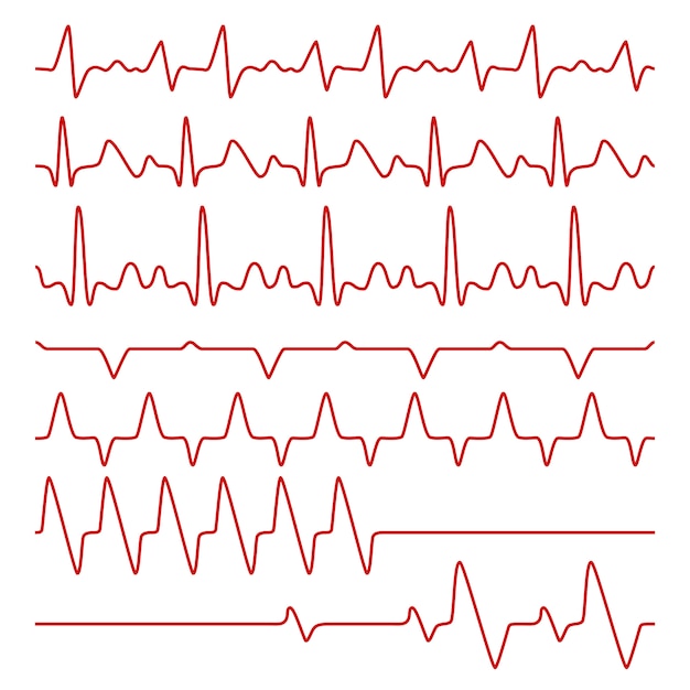 Premium Vector Line cardiograms or electrocardiogram on monitor