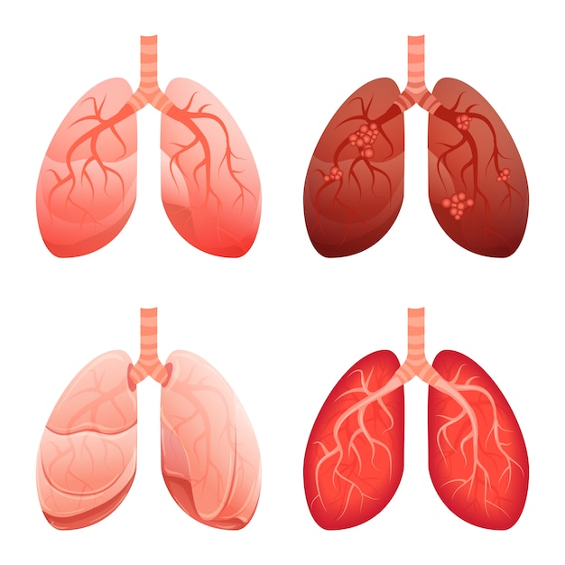 肺のアイコンセット 漫画のスタイル プレミアムベクター