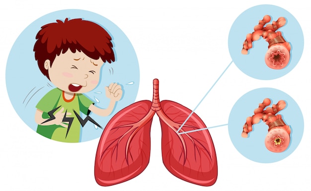 A man having chronic obstructive pulmonary disease Premium Vector