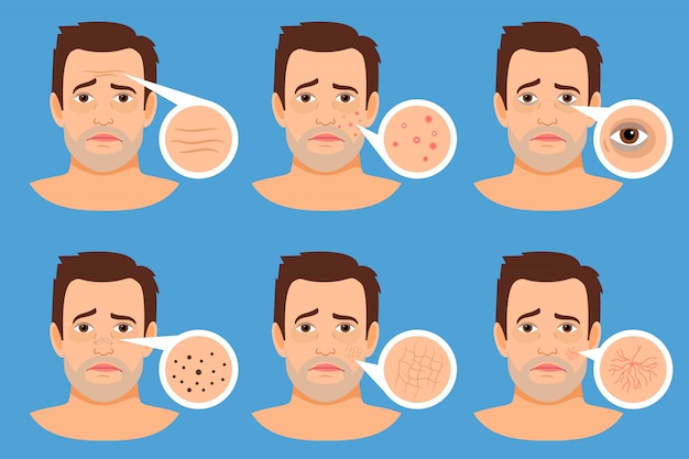 男の肌の問題はベクトルイラストです にきびやダークスポット しわ にきびの男性の顔 プレミアムベクター