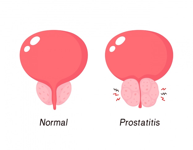 Stock fotó — Normal prostate gland isolated on white background, 3D illustration