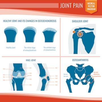 Premium Vector | Osteoarthritis and rheumatism joint pain medical ...