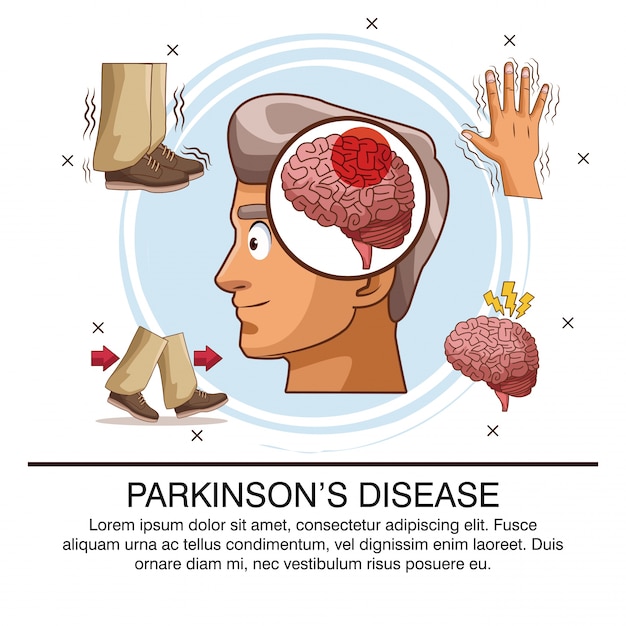 Premium Vector Parkinsons Disease Infographic 3714