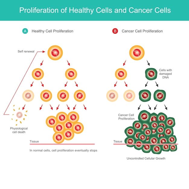 Premium Vector | Proliferation of healthy cells and cancer cells.  comparison illustration of normal cell proliferation and cancer cell  proliferation in the body.