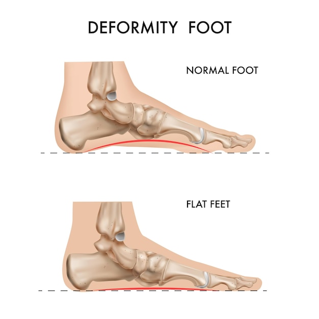 Free Vector Realistic Bones Of Anatomy Foot