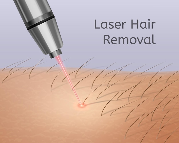 Premium Vector Realistic Illustration Of Laser Hair Removal On Legs