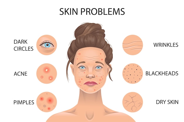  Skin problems. vector illustration. Premium Vector