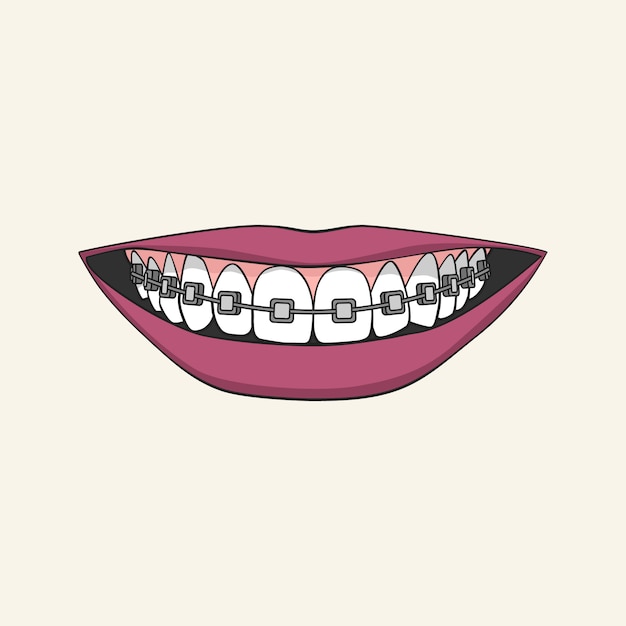 Free Free Smile With Braces Svg 370 SVG PNG EPS DXF File