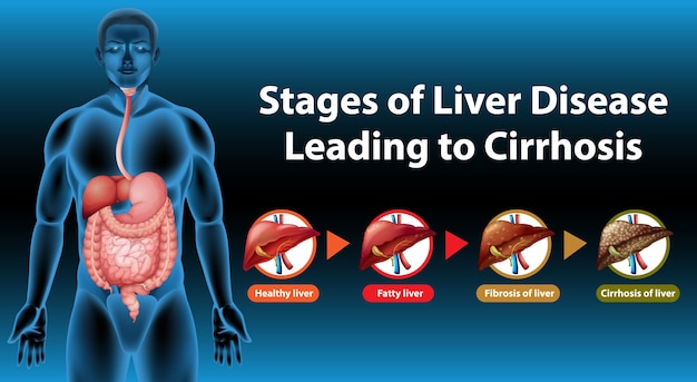 Premium Vector | Stages of liver disease leading to cirrhosis
