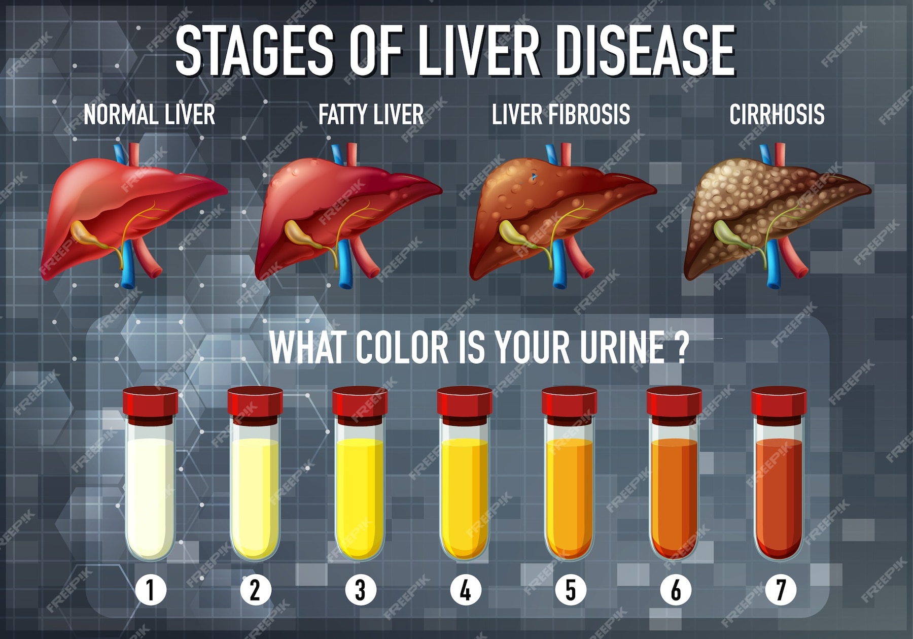 Free Vector | Stages of liver disease