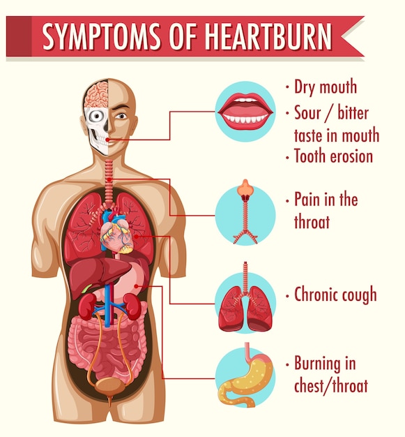 Symptoms of heartburn information