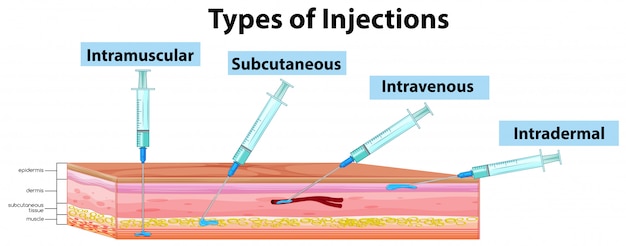 Free Vector | Types of injections diagram