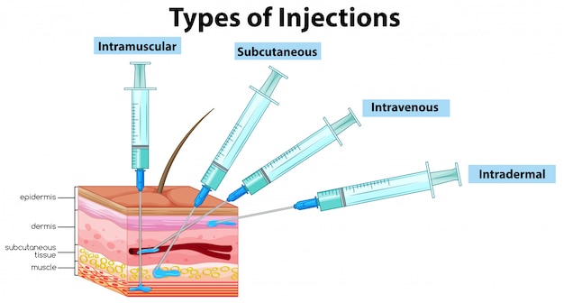 Premium Vector | Types of injections on white background