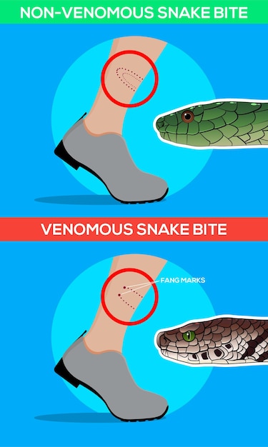 premium-vector-venomous-and-non-venomous-snake-bite-in-the-leg