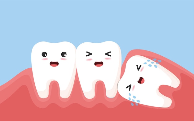 Premium Vector | Wisdom tooth push other tooth. impacted wisdom tooth ...