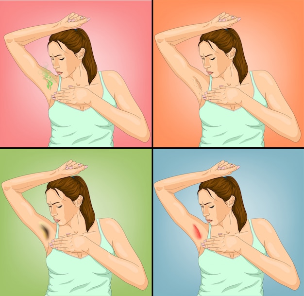 Underarm-Care-101