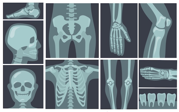 Free Vector X Ray Shots Of Human Body