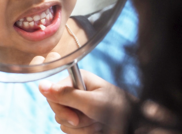 Bebe Dent D Une Fillette Thailandaise Un Enfant Asiatique Regarde Dans Le Miroir Pour Voir Ses Dents Se Detacher Des Gencives Problemes De Sante Dentaire Des Enfants Photo Premium