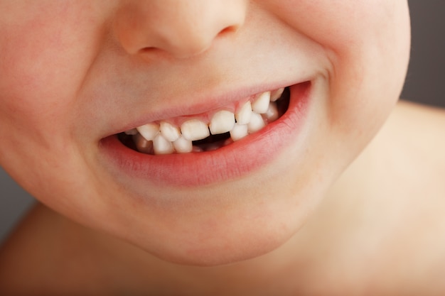 Un Sourire D Enfant Sans Dents De Bebe Inferieures Un Trou Dans Le Sourire D Un Enfant Concept Amusant Photo Premium