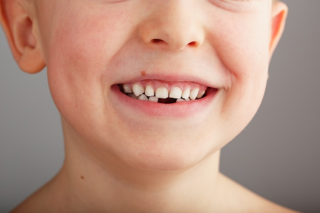 Un Sourire D Enfant Sans Dents De Bebe Inferieures Un Trou Dans Le Sourire D Un Enfant Concept Amusant Photo Premium