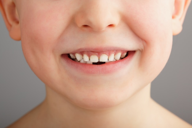 Il Sorriso Di Un Bambino Senza Denti Da Latte Piu Bassi Un Buco Nel Sorriso Di Un Bambino Concetto Divertente Foto Premium