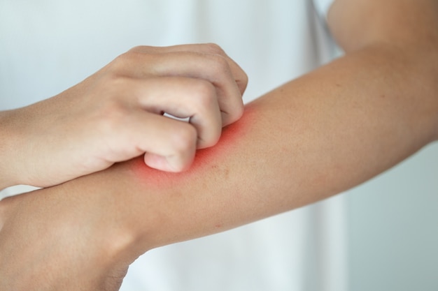 eczema pruriginoso foto vörös pikkelyű pikkelyes folt a bőrön