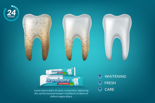 Affiche Publicitaire De Dentifrice Blanchissant.  Vecteur Premium